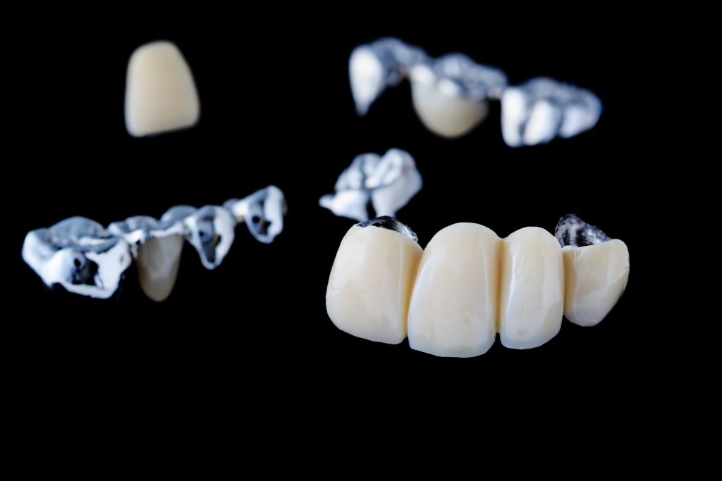 dental bridges near you