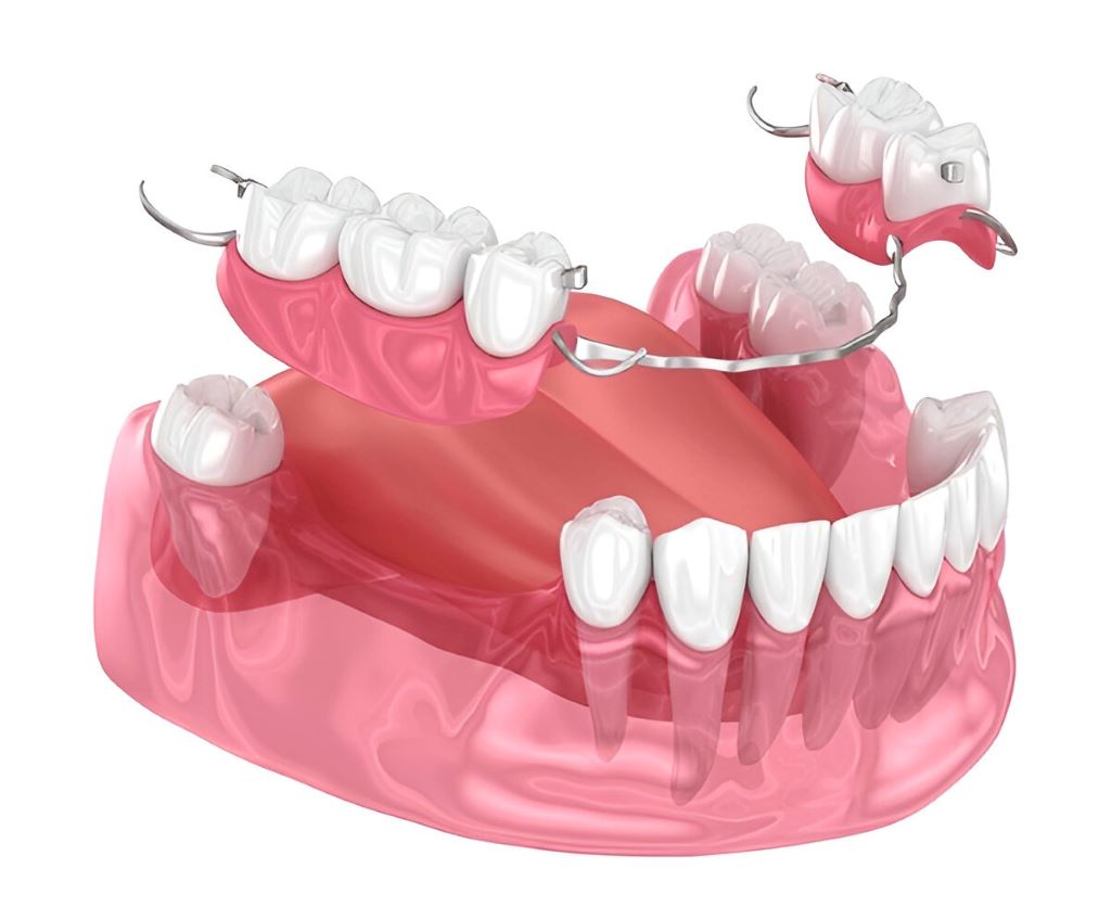 dentures & partials near you