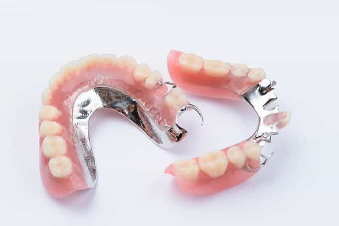 dentures & partials nw calgary