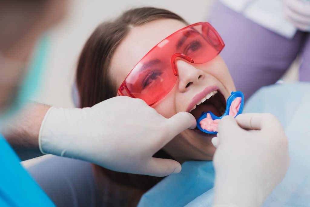 fluoride treatment in nw calgary