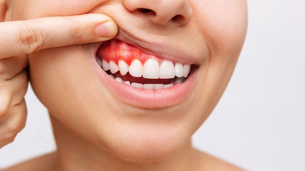 periodontal treatment in nw calgary